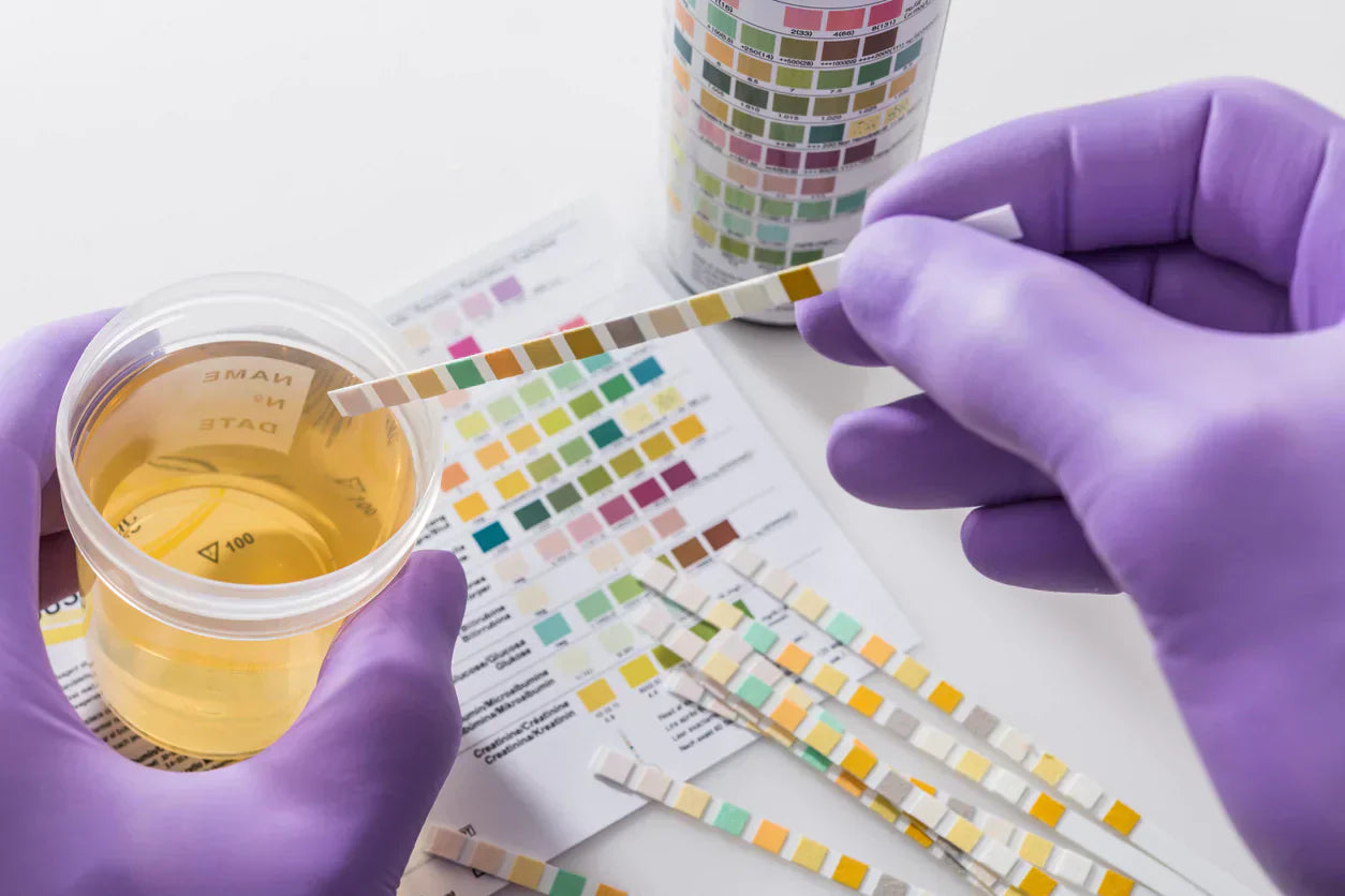 Gloved hands testing a urine sample with reagent strips in a medical lab.